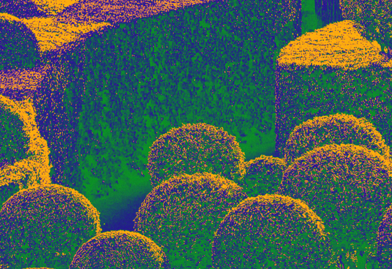 Kuvassa on puutarhakuva, jossa on pistemäisesti kuvitettuna kumpuja ja värit ovat keltainen, violetti ja vihreä.