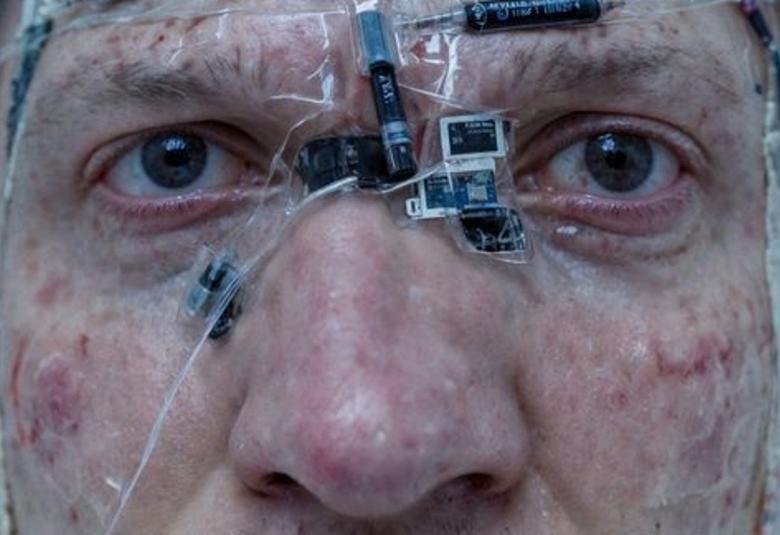 Kuvassa on miehen kasvot ja hänellä on otsassa musta pieni kanyyli ja mikropiirejä nenän molemmin puolin.  Poskissa on läpinäkyvää muovia.